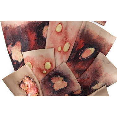 Safeguard Medical-SimBODIES Burns & Blisters Simulation Sleeves Kit-MedTech-1